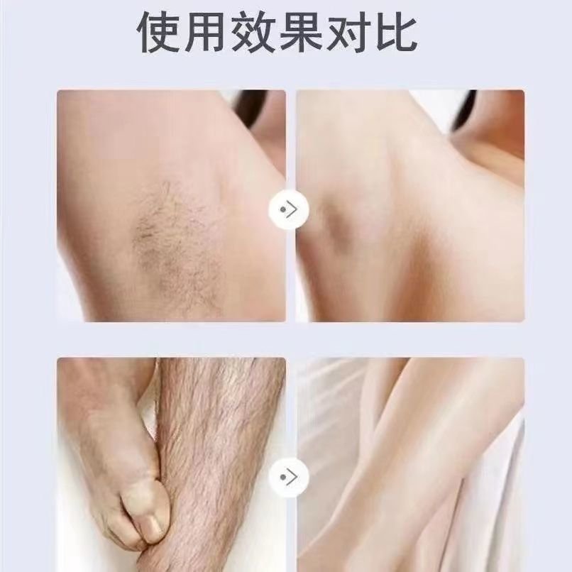 Многофункциональный электрический триммер для удаления волос для мужчин и женщин оптом из Китая