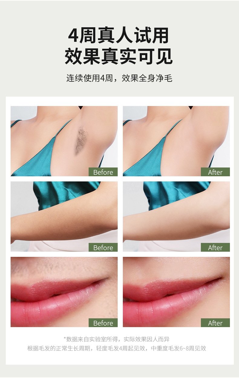 Лазерный эпилятор с функцией криотерапии оптом из Китая