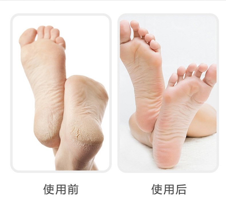 Новый деревянный нано-эпилятор для удаления ороговевшей кожи и волос 2 в 1 оптом из Китая