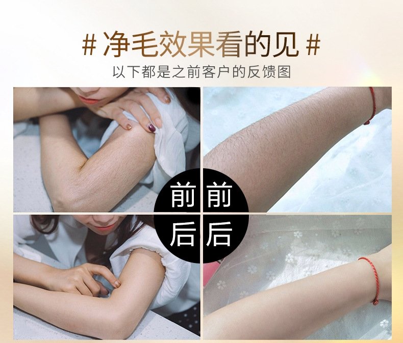 IPL фотоэпилятор для домашнего использования оптом из Китая