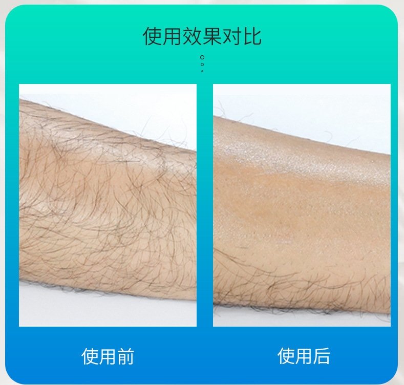 Машинка для удаления волос с нано-стеклом оптом из Китая