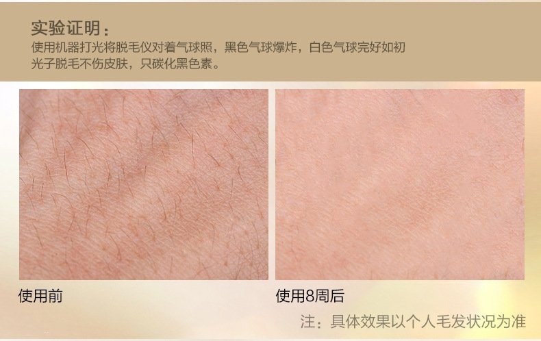 IPL фотоэпилятор для домашнего использования оптом из Китая